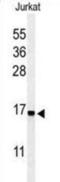 Ribosomal Protein S25 antibody, abx034482, Abbexa, Western Blot image 