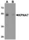 Karyopherin Subunit Alpha 7 antibody, TA326608, Origene, Western Blot image 