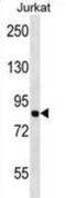 Minichromosome Maintenance Complex Component 7 antibody, abx028737, Abbexa, Western Blot image 