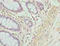 Actin Gamma 2, Smooth Muscle antibody, A64164-100, Epigentek, Immunohistochemistry paraffin image 