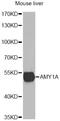 Amylase Alpha 1C (Salivary) antibody, LS-C748334, Lifespan Biosciences, Western Blot image 