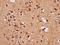 Small Nuclear Ribonucleoprotein Polypeptide E antibody, LS-C681411, Lifespan Biosciences, Immunohistochemistry paraffin image 