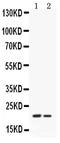 Epiregulin antibody, PB9864, Boster Biological Technology, Western Blot image 