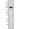 Inositol Polyphosphate-4-Phosphatase Type II B antibody, abx216243, Abbexa, Western Blot image 