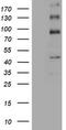 ALK Receptor Tyrosine Kinase antibody, TA801178BM, Origene, Western Blot image 