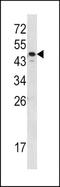 Serpin Family A Member 7 antibody, TA324862, Origene, Western Blot image 