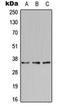 Bone Marrow Stromal Cell Antigen 2 antibody, orb213619, Biorbyt, Western Blot image 