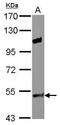 Tyrosinase antibody, PA5-27324, Invitrogen Antibodies, Western Blot image 