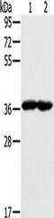 G Protein Subunit Alpha Transducin 3 antibody, TA351226, Origene, Western Blot image 