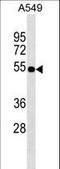 Tis11d antibody, LS-C157404, Lifespan Biosciences, Western Blot image 