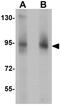 Zinc Finger And BTB Domain Containing 5 antibody, GTX31423, GeneTex, Western Blot image 
