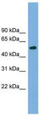 Tubulin Beta 4A Class IVa antibody, TA340088, Origene, Western Blot image 