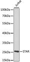 Steroidogenic Acute Regulatory Protein antibody, MBS126761, MyBioSource, Western Blot image 