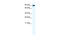 Glutamate Ionotropic Receptor Kainate Type Subunit 2 antibody, 28-274, ProSci, Enzyme Linked Immunosorbent Assay image 