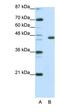 Achaete-Scute Family BHLH Transcription Factor 3 antibody, orb329916, Biorbyt, Western Blot image 