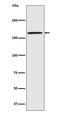 Contactin Associated Protein 1 antibody, M08617, Boster Biological Technology, Western Blot image 