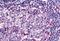 Sterile Alpha And TIR Motif Containing 1 antibody, NBP1-77200, Novus Biologicals, Immunohistochemistry paraffin image 