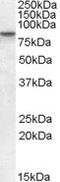 SET Domain Bifurcated Histone Lysine Methyltransferase 2 antibody, LS-C54492, Lifespan Biosciences, Western Blot image 