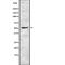 Methionyl Aminopeptidase 2 antibody, abx216811, Abbexa, Western Blot image 