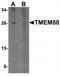 Transmembrane Protein 88 antibody, TA320074, Origene, Western Blot image 