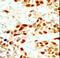 Death Associated Protein Kinase 2 antibody, LS-C100744, Lifespan Biosciences, Immunohistochemistry frozen image 