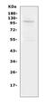 Transient Receptor Potential Cation Channel Subfamily C Member 6 antibody, PA1754, Boster Biological Technology, Western Blot image 