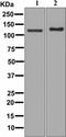 Pyruvate Carboxylase antibody, ab126707, Abcam, Western Blot image 