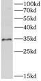 Sulfotransferase Family 1A Member 1 antibody, FNab10011, FineTest, Western Blot image 