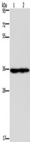 NADH:Ubiquinone Oxidoreductase Subunit A9 antibody, TA350211, Origene, Western Blot image 