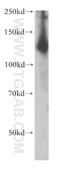 Adenylate Cyclase 6 antibody, 14616-1-AP, Proteintech Group, Western Blot image 