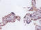 FAS antibody, LS-C211648, Lifespan Biosciences, Immunohistochemistry paraffin image 