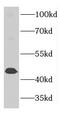 Mitochondrial Ribosome Associated GTPase 2 antibody, FNab03723, FineTest, Western Blot image 