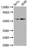 SMAD2 antibody, CSB-RA618017A250phHU, Cusabio, Western Blot image 