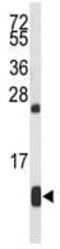 Hemoglobin Subunit Alpha 2 antibody, ab102758, Abcam, Western Blot image 