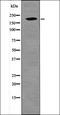 Platelet Derived Growth Factor Receptor Beta antibody, orb335683, Biorbyt, Western Blot image 