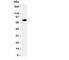 Protein Kinase C Alpha antibody, R30246, NSJ Bioreagents, Western Blot image 