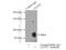 Clathrin Interactor 1 antibody, 10470-1-AP, Proteintech Group, Immunoprecipitation image 