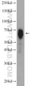 NUMB Like Endocytic Adaptor Protein antibody, 10111-1-AP, Proteintech Group, Western Blot image 