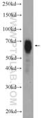 Numb-like protein antibody, 10111-1-AP, Proteintech Group, Western Blot image 