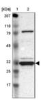 Glucosamine-6-Phosphate Deaminase 1 antibody, NBP1-83355, Novus Biologicals, Western Blot image 