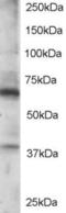 Regulator Of G Protein Signaling 14 antibody, 46-288, ProSci, Western Blot image 