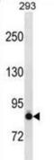 Cadherin 6 antibody, abx027843, Abbexa, Western Blot image 