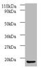 Adaptor Related Protein Complex 1 Subunit Sigma 3 antibody, A53257-100, Epigentek, Western Blot image 