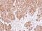 Eukaryotic Translation Initiation Factor 5A antibody, PA5-29204, Invitrogen Antibodies, Immunohistochemistry paraffin image 