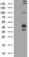 Fc Fragment Of IgE Receptor II antibody, NBP2-45624, Novus Biologicals, Western Blot image 