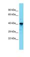 Retinoic Acid Receptor Alpha antibody, orb330263, Biorbyt, Western Blot image 