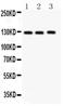 Fibulin 2 antibody, PA5-79239, Invitrogen Antibodies, Western Blot image 