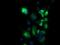 Protein Kinase, Membrane Associated Tyrosine/Threonine 1 antibody, GTX83876, GeneTex, Immunocytochemistry image 