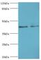 Branched-chain-amino-acid aminotransferase, mitochondrial antibody, LS-C375306, Lifespan Biosciences, Western Blot image 