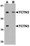 Tectonic Family Member 3 antibody, A12051, Boster Biological Technology, Western Blot image 